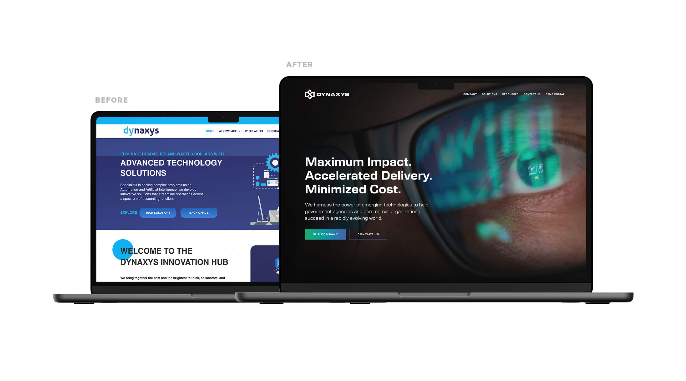 dynaxys before after web